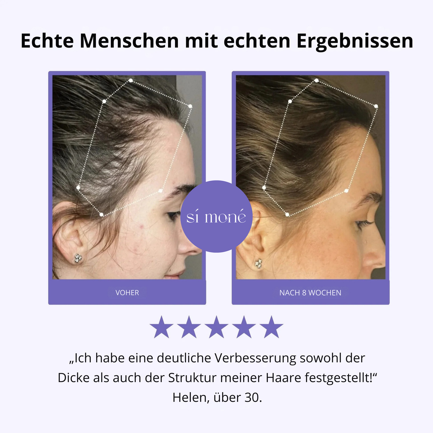 Sí Moné Scalp Massager