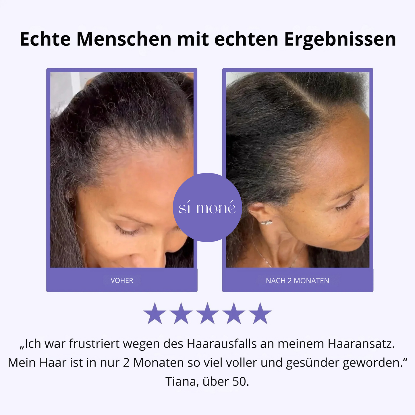 Sí Moné Scalp Massager