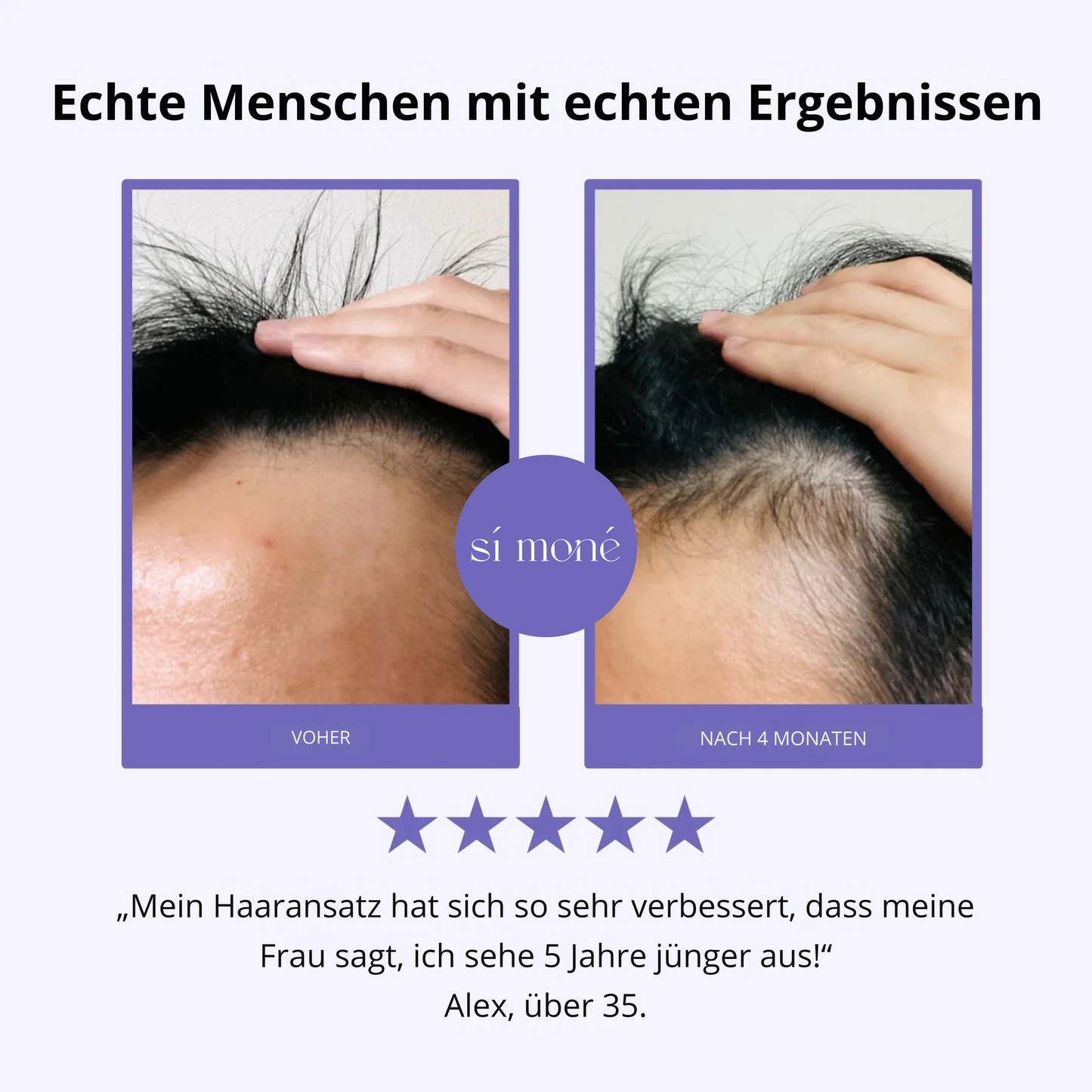Sí Moné Scalp Massager
