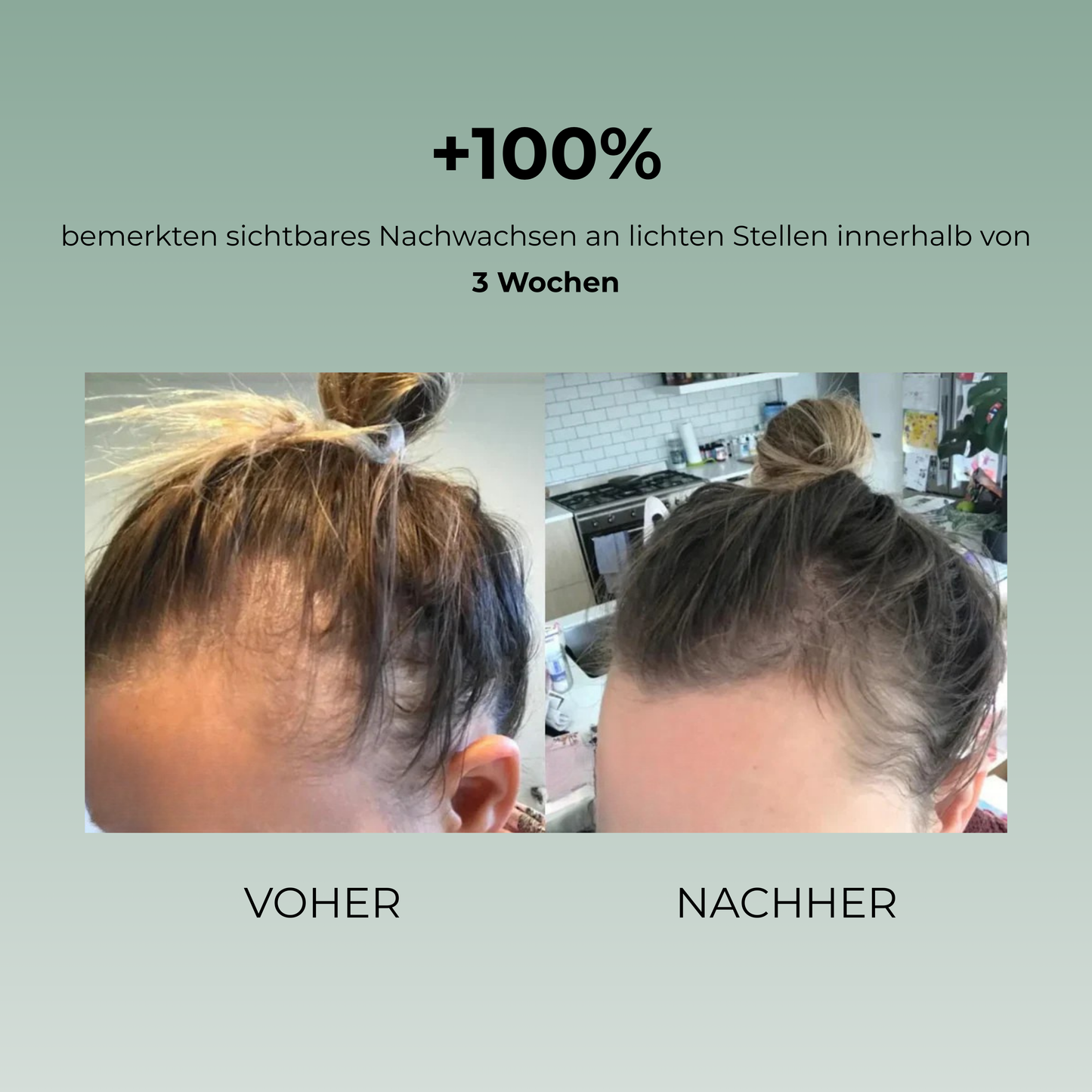 Batana Base Natürliche Haarwuchsöl