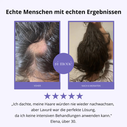 Sí Moné Scalp Massager