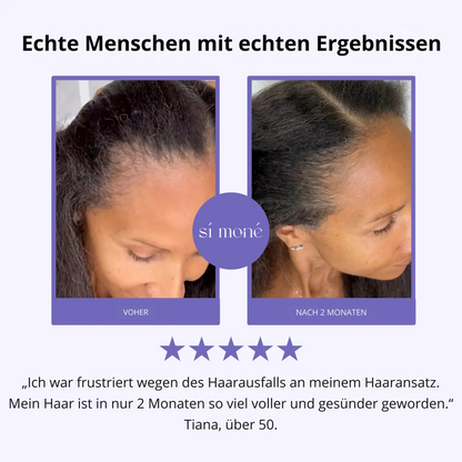 Sí Moné Scalp Massager