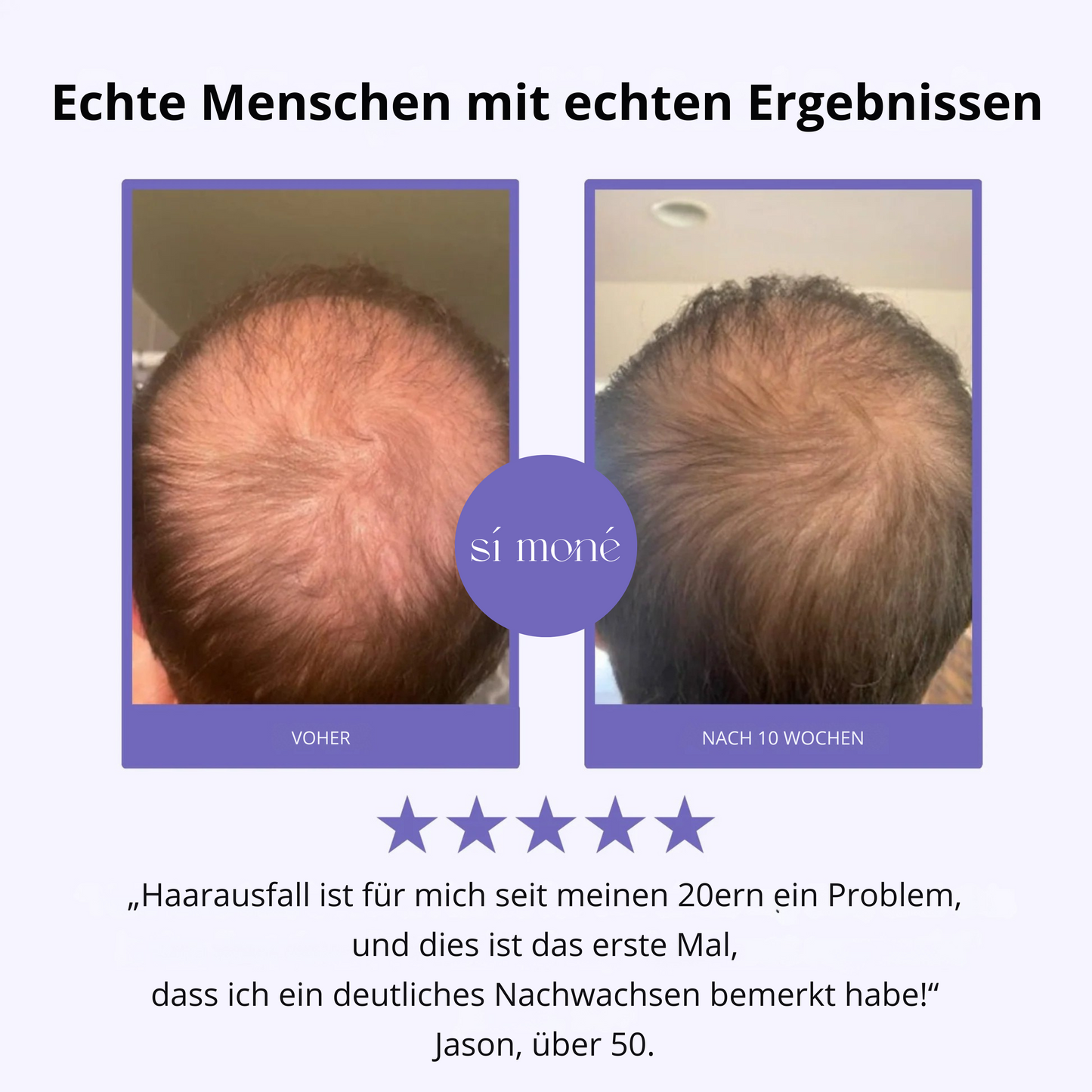 Sí Moné Scalp Massager