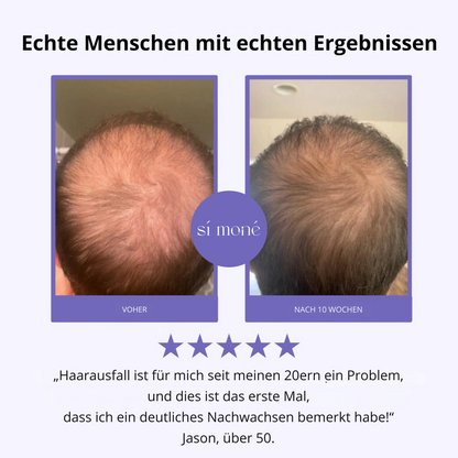 Sí Moné Scalp Massager