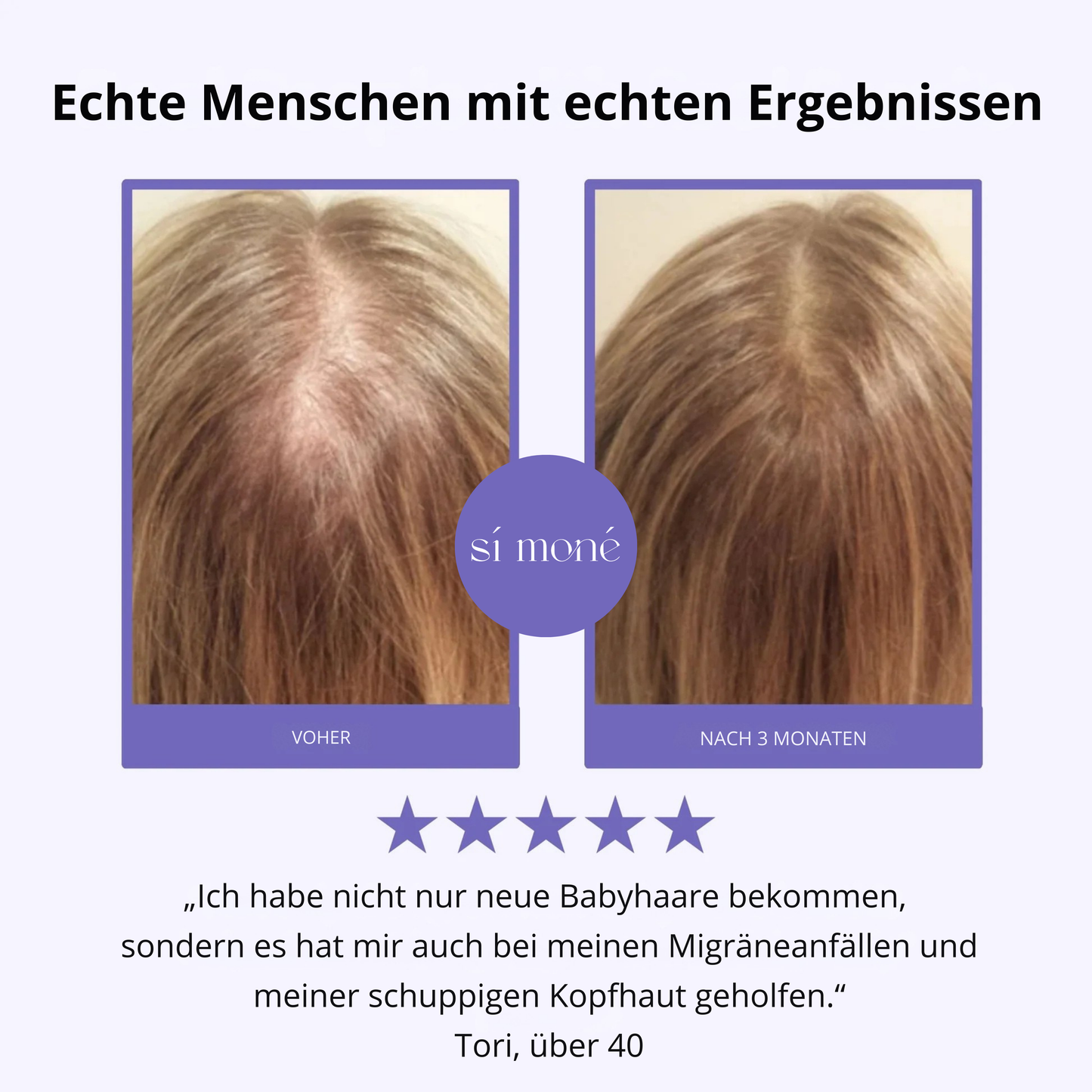 Sí Moné Scalp Massager